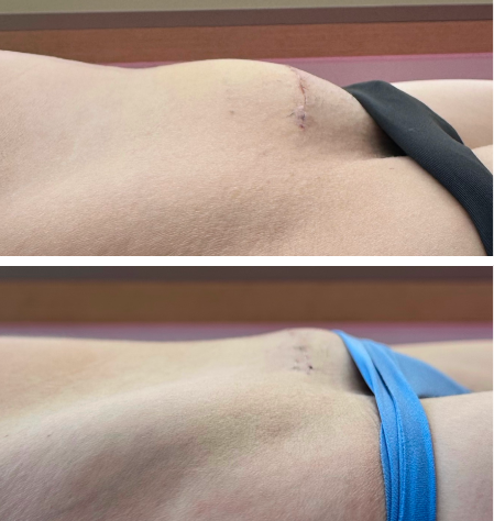 antes e depois 1