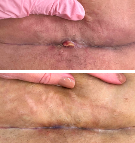 antes e depois 2