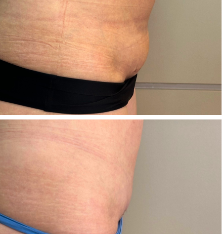 antes e depois 3
